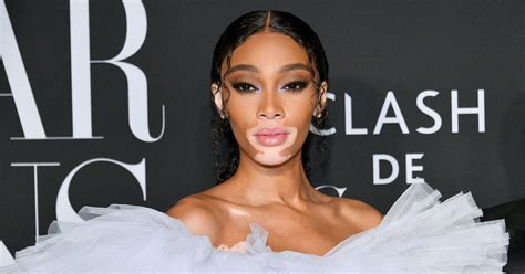 winnie harlow net worth|Winnie Harlow Biography: Husband, Net Worth,。